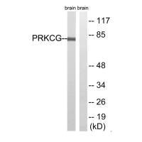 Western blot analysis of extracts from Rat brain cells, using PRKCG(Ab-655) antibody.