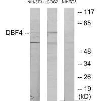 Western blot analysis of extracts from NIH-3T3 cells treated with H2O2 (100uM, 30mins) and COS-7 cells treated with PMA (125mg/ml, 30mins), using DBF4 antibody.
