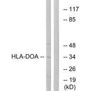 Western blot analysis of extracts from COLO cells, using HLA-DOA antibody.