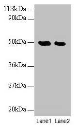 Western blot All lanes: LCAT antibody at 2µg/ml Lane 1: EC109 whole cell lysate Lane 2: 293T whole cell lysate Secondary Goat polyclonal to rabbit IgG at 1/10000 dilution Predicted band size: 50 kDa Observed band size: 50 kDa