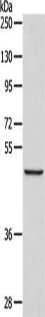 Gel: 10%SDS-PAGE, Lysate: 40 ug, Lane: Mouse pancreas tissue, Primary antibody: CSB-PA113733(ALKBH1 Antibody) at dilution 1/250, Secondary antibody: Goat anti rabbit IgG at 1/8000 dilution, Exposure time: 2 minutes