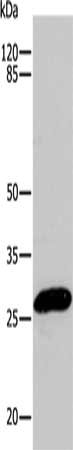 Gel: 10%SDS-PAGE, Lysate: 24 ug, Lane: Hela cells, Primary antibody: CSB-PA113748(CBX5 Antibody) at dilution 1/200, Secondary antibody: Goat anti rabbit IgG at 1/8000 dilution, Exposure time: 1 minute