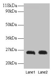 Western blot All lanes: CSH1 antibody at 2µg/ml Lane 1: A549 whole cell lysate Lane 2: U251 whole cell lysate Secondary Goat polyclonal to rabbit IgG at 1/15000 dilution Predicted band size: 26 kDa Observed band size: 26 kDa