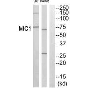 Western blot analysis of extracts from Jurkat cells and HepG2 cells, using MIC1 antibody.