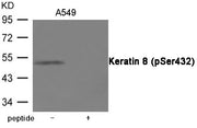 Western blot analysis of extracts from A549 cells using Keratin 8 (Phospho-Ser432) Antibody.The lane on the right is treated with the antigen-specific peptide.