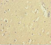 Immunohistochemistry of paraffin-embedded human brain tissue using CSB-PA11407A0Rb at dilution of 1:100