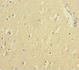 Immunohistochemistry of paraffin-embedded human brain tissue using CSB-PA11407A0Rb at dilution of 1:100