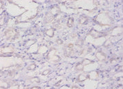 Immunohistochemistry of paraffin-embedded human kidney tissue using CSB-PA11409A0Rb at dilution of 1:20