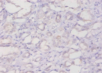 Immunohistochemistry of paraffin-embedded human kidney tissue using CSB-PA11409A0Rb at dilution of 1:20