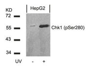 Western blot analysis of extracts from HepG2 cells untreated or treated with UV using Chk1(Phospho-Ser280) Antibody.