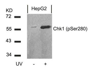 Western blot analysis of extracts from HepG2 cells untreated or treated with UV using Chk1(Phospho-Ser280) Antibody.