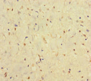 Immunohistochemistry of paraffin-embedded human smooth muscle tissue using CSB-PA11439A0Rb at dilution of 1:100
