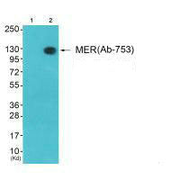 Western blot analysis of extracts from 3T3 cells (Lane 2), using MER (Ab-753) antiobdy. The lane on the left is treated with synthesized peptide.