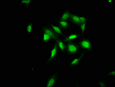 Immunofluorescence staining of U251 cells with CSB-PA11469A0Rb at 1:100, counter-stained with DAPI. The cells were fixed in 4% formaldehyde, permeabilized using 0.2% Triton X-100 and blocked in 10% normal Goat Serum. The cells were then incubated...