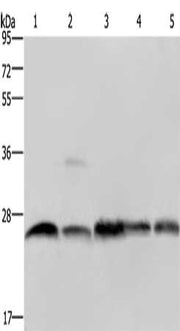 Gel: 10%SDS-PAGE, Lysate: 40 ug, Lane 1-5: A549 cells, Jurkat cells, mouse heart tissue, mouse skeletal muscle tissue, Raw264.7 cells, Primary antibody: CSB-PA114840(NDUFV2 Antibody) at dilution 1/200, Secondary antibody: Goat anti rabbit IgG at 1...