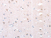 The image on the left is immunohistochemistry of paraffin-embedded Human brain tissue using CSB-PA114923(DTX1 Antibody) at dilution 1/20, on the right is treated with synthetic peptide. (Original magnification: ×200)