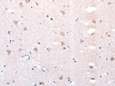 The image on the left is immunohistochemistry of paraffin-embedded Human brain tissue using CSB-PA114923(DTX1 Antibody) at dilution 1/20, on the right is treated with synthetic peptide. (Original magnification: ×200)