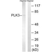 Western blot analysis of extracts from HepG2 cells, using PLK3 antibody.
