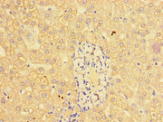 Immunohistochemistry of paraffin-embedded human liver tissue using CSB-PA11499A0Rb at dilution of 1:100