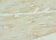 Immunohistochemistry of paraffin-embedded human skeletal muscle tissue using CSB-PA11504A0Rb at dilution of 1:100