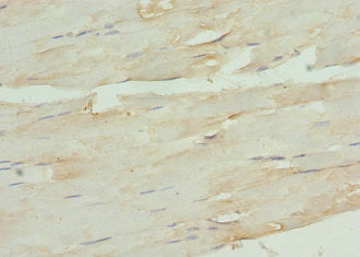 Immunohistochemistry of paraffin-embedded human skeletal muscle tissue using CSB-PA11504A0Rb at dilution of 1:100