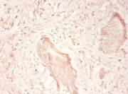 Immunohistochemistry of paraffin-embedded human prostate tissue using CSB-PA11509A0Rb at dilution of 1:50