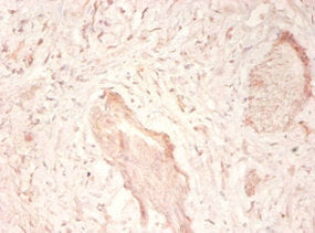 Immunohistochemistry of paraffin-embedded human prostate tissue using CSB-PA11509A0Rb at dilution of 1:50