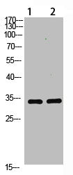 Western Blot analysis of 1,293T 2,mouse-brain cells using primary antibody diluted at 1:1000(4°C overnight). Secondary antibody:Goat Anti-rabbit IgG IRDye 800( diluted at 1:5000, 25°C, 1 hour)