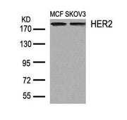 Western blot analysis of extracts from MCF and SKOV3 cells using HER2(Ab-1248) Antibody.