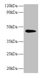 Western blot All lanes: NAPSA antibody at 2µg/ml + Mouse kidney tissue Secondary Goat polyclonal to rabbit IgG at 1/10000 dilution Predicted band size: 46 kDa Observed band size: 46 kDa
