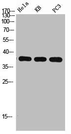 Western Blot analysis of HELA KB PC-3 using p38 Polyclonal Antibody. Antibody was diluted at 1:1000. Secondary antibody was diluted at 1:20000