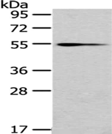 Gel: 8%SDS-PAGE,Lysate: 40 ug,,Primary antibody: CSB-PA115333(UGT1A4 Antibody) at dilution 1/200 dilution,Secondary antibody: Goat anti rabbit IgG at 1/8000 dilution,Exposure time: 10 minutes