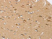 The image on the left is immunohistochemistry of paraffin-embedded Human brain tissue using CSB-PA115417(SEZ6L Antibody) at dilution 1/30, on the right is treated with synthetic peptide. (Original magnification: ×200)