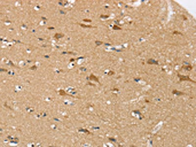 The image on the left is immunohistochemistry of paraffin-embedded Human brain tissue using CSB-PA115417(SEZ6L Antibody) at dilution 1/30, on the right is treated with synthetic peptide. (Original magnification: ×200)