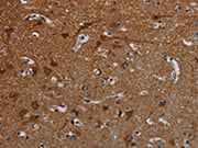 The image on the left is immunohistochemistry of paraffin-embedded Human brain tissue using CSB-PA115469(PCDHB15 Antibody) at dilution 1/50, on the right is treated with synthetic peptide. (Original magnification: ×200)