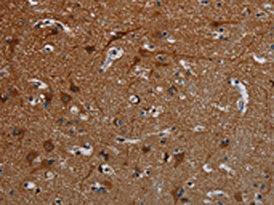 The image on the left is immunohistochemistry of paraffin-embedded Human brain tissue using CSB-PA115469(PCDHB15 Antibody) at dilution 1/50, on the right is treated with synthetic peptide. (Original magnification: ×200)