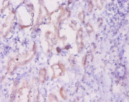 Immunohistochemistry of paraffin-embedded human kidney tissue using CSB-PA11559A0Rb at dilution of 1:20