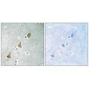Immunohistochemistry analysis of paraffin-embedded human brain tissue using PECAM-1 (Ab-713) antibody.