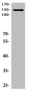 Western Blot analysis of Hela cells using primary antibody diluted at 1:1000(4°C overnight). Secondary antibody:Goat Anti-rabbit IgG IRDye 800( diluted at 1:5000, 25°C, 1 hour)