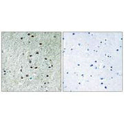 Immunohistochemistry analysis of paraffin-embedded human brain tissue using REXO1 antibody.