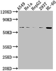 Western Blot Positive WB detected in: A549 whole cell lysate, Hela whole cell lysate, HepG2 whole cell lysate, 293T whole cell lysate, HL60 whole cell lysate All lanes: MDM2 antibody at 1:2000 Secondary Goat polyclonal to rabbit IgG at 1/50000 dil...
