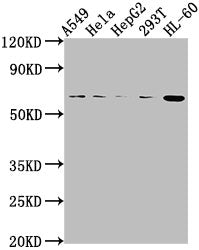 Western Blot Positive WB detected in: A549 whole cell lysate, Hela whole cell lysate, HepG2 whole cell lysate, 293T whole cell lysate, HL60 whole cell lysate All lanes: MDM2 antibody at 1:2000 Secondary Goat polyclonal to rabbit IgG at 1/50000 dil...