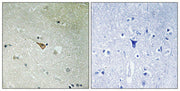 Immunohistochemical analysis of paraffin-embedded human brain tissue, using ALK (Phospho-Tyr1096) antibody (left)or the same antibody preincubated with blocking peptide (right).