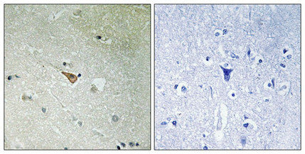 Immunohistochemical analysis of paraffin-embedded human brain tissue, using ALK (Phospho-Tyr1096) antibody (left)or the same antibody preincubated with blocking peptide (right).