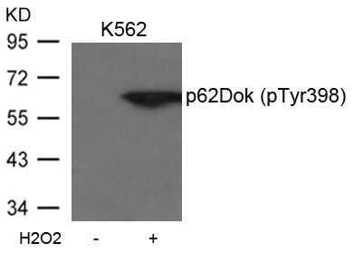Western blot analysis of extracts from K562 cells untreated or treated with H2O2 using p62Dok(phospho-Tyr398) Antibody.