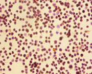 Immunohistochemistry of paraffin-embedded EC109 cells using CSB-PA11659A0Rb at dilution of 1:50