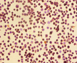 Immunohistochemistry of paraffin-embedded EC109 cells using CSB-PA11659A0Rb at dilution of 1:50