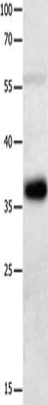 Gel: 10%SDS-PAGE, Lysate: 40 ug, Lane: Mouse heart tissue, Primary antibody: CSB-PA116739(MAGEA2 Antibody) at dilution 1/2100, Secondary antibody: Goat anti rabbit IgG at 1/8000 dilution, Exposure time: 20 seconds