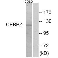 Western blot analysis of extracts from COLO cells, using CEBPZ antibody.