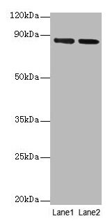 Western blot All lanes: FOLH1 antibody at 2µg/ml Lane 1: U251 whole cell lysate Lane 2: PC-3 whole cell lysate Secondary Goat polyclonal to rabbit IgG at 1/10000 dilution Predicted band size: 85, 13, 10, 78, 83, 81, 79, 51 kDa Observed band size:...
